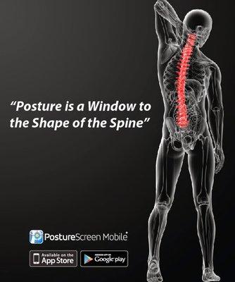 Postural analysis and correction offered at College Station Chiropractic