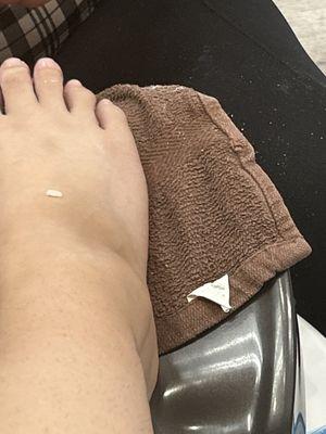 My friends toenail got ripped off And painted over with the nail polish after it was still bleeding.