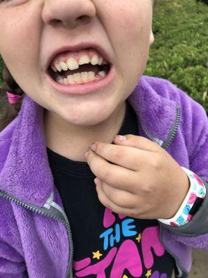 When my daughter broke her tooth at school Dr. Roghani made herself available to save the day. She did masterful work! Thank you Dr Roghani!