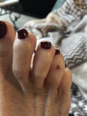 Day after pedi