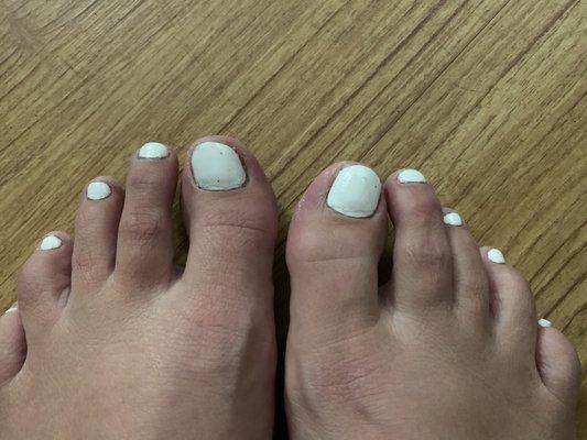 I swear my toes are not always that ugly. I mean... what is that?! :(