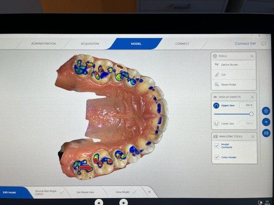 Primescan processes more data with higher resolution. In an instant, laboratories and other partners can receive high-resolution models.