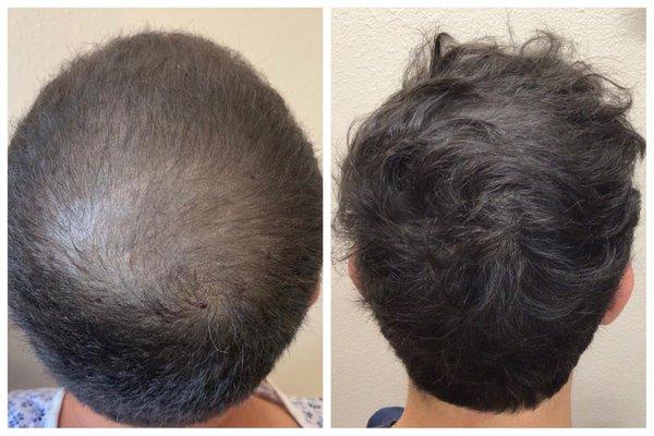 La Mesa Medical Hair Restoration Inc.