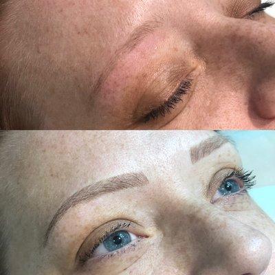 Microblading