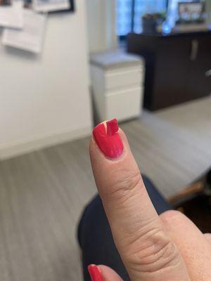 Horrible chip in gel within 48 hours of the manicure.