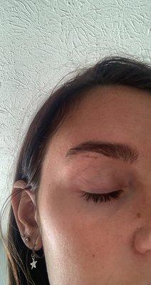 my eyebrow got pinched really bad from the threading