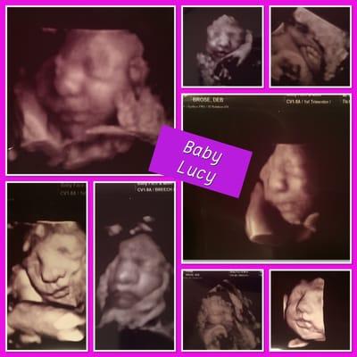 Got many great shots of our little one at 30weeks