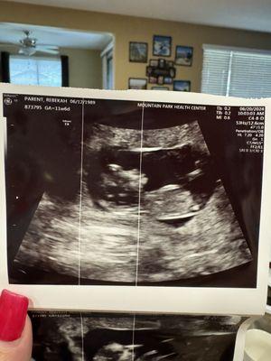 & this is our little girl who is due in January