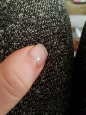 Missing left corner of the nail...