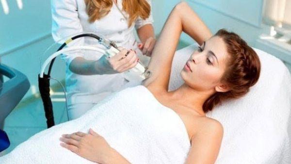 Laser hair removal