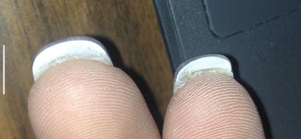 You can see material under both nails & the sharp material under the nail on the right, it is cutting into my finger.