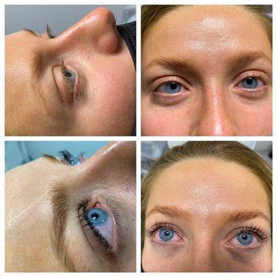 Beautiful before and after I lash lift and tint
Service by Ricki Criswell