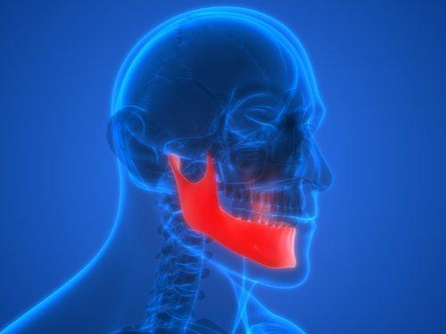 Herron Law specializes in TMJ injuries after a car crash or other personal injury