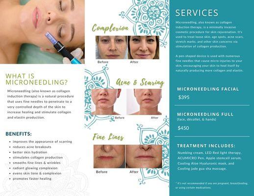 microneedling