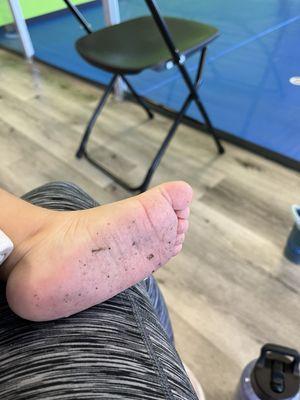 My child's feet after class... clearly the mats aren't being cleaned enough as this was the second class of the day.