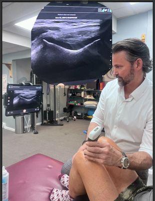 Musculoskeletal ultrasound of the knee cap joint space.  (Taken with permission)