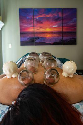 Body cupping for muscle tension, pain relief.