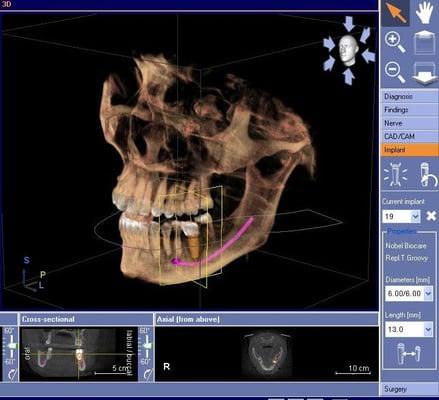 We have 3D Xray imaging on site!