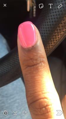 You can see the dried up blood around my cuticle area & uneven nail. Smh