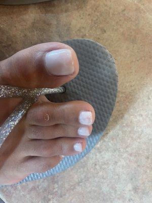 Smudged toe nails. Obvious cuticles.