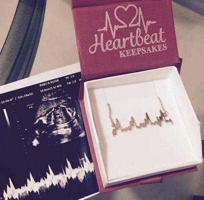 Capture your baby's or loved one's heartbeat on personalized Keepsake Jewelry. Call today for an appointment.