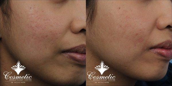 Cosmetic Dermatology Center