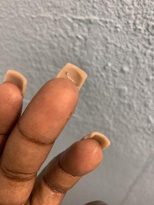 Cracked nail