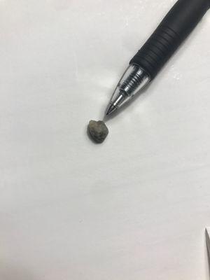 Stone found in burrito