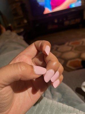 peeling nail same day