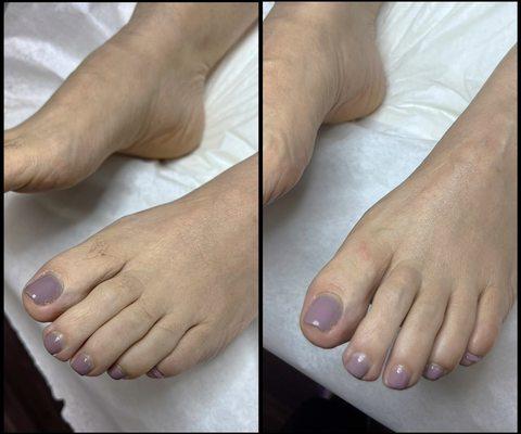 Feet and toe wax before & after.