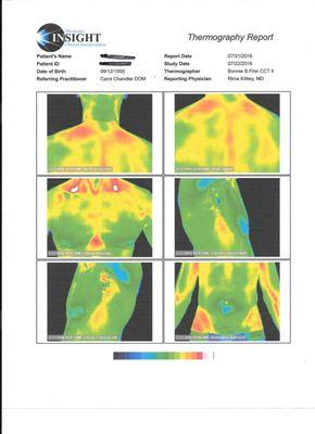 Thermal Imaging Example