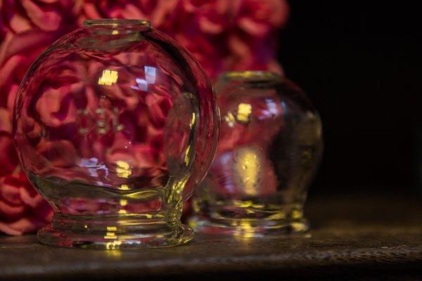 Cupping...this ancient technique does wonders for pain.