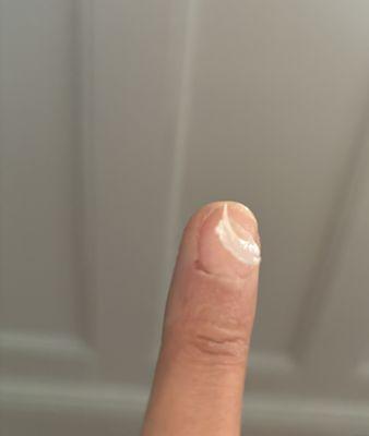 Peeling clear polish and the cuticle is still raw even 2 days later.