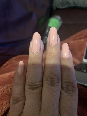 Nail on my cuticles