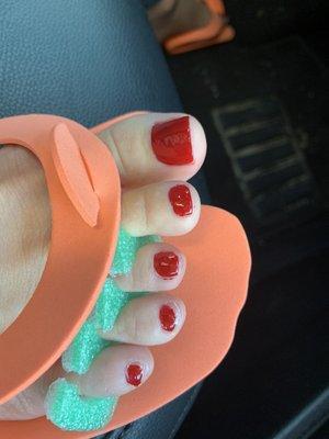 Shitty pedicure