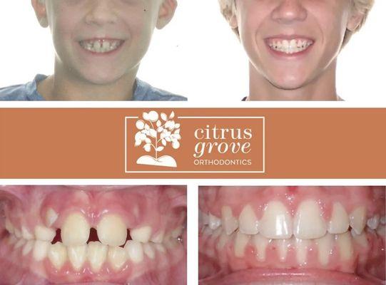 Check out this Smile Transformation