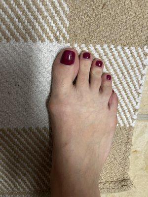 Gel pedicure