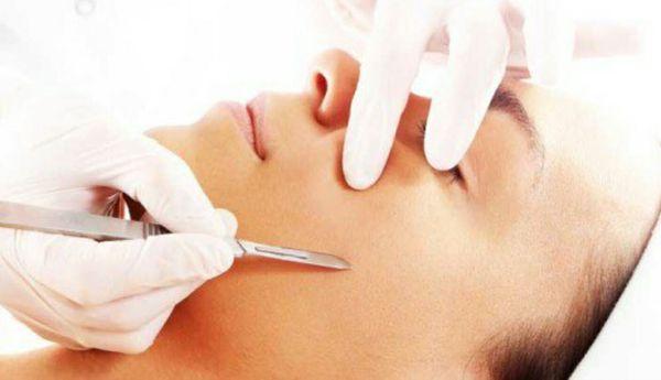 Dermaplaning treatments  @The Hidden Spa, suite 121 954-696-5828