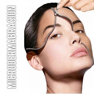 Microdermabrasion