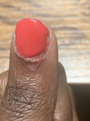 Regal nails finger damage.