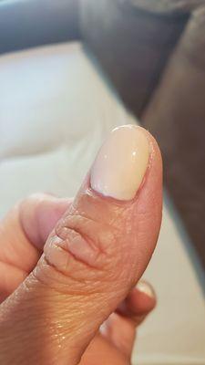 Cuticle cut.