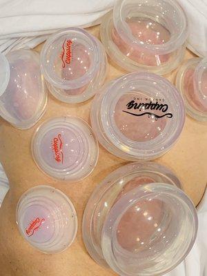 Cupping