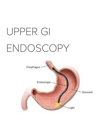 Upper Endoscopy to Evaluate Upper Abdominal pain