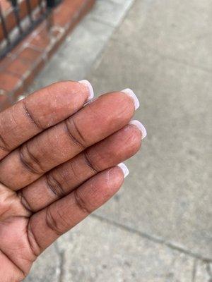 Under nails not cleaned