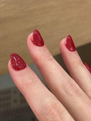 Bleeding nails