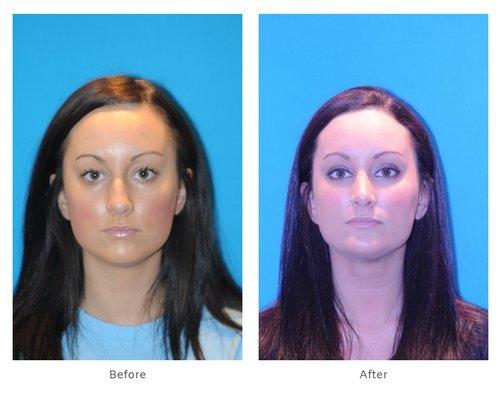 Clymer Facial Plastic Surgery