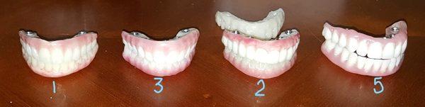 1) Dr. Soter 1st set, 2) Soter's 2nd (not delivered) 3) Kostas 1st CO lab set 4) Kostas last set.