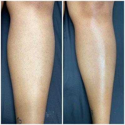 Before and After Leg Wax