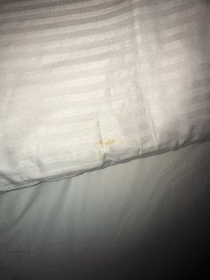 Stains on the pillow case