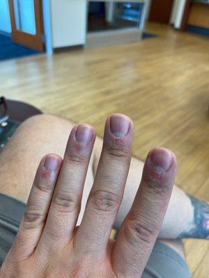 Terrible manicure, cuticle not cut, nails not buffed.